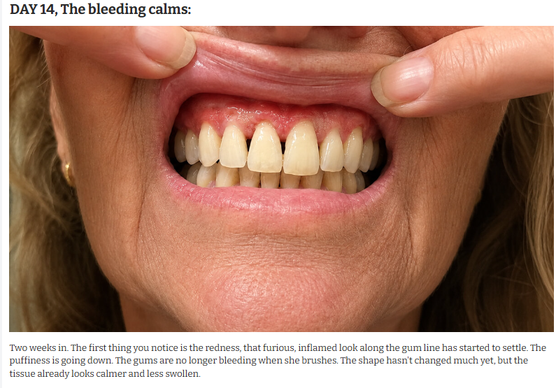Day 14 Bleeding Calms