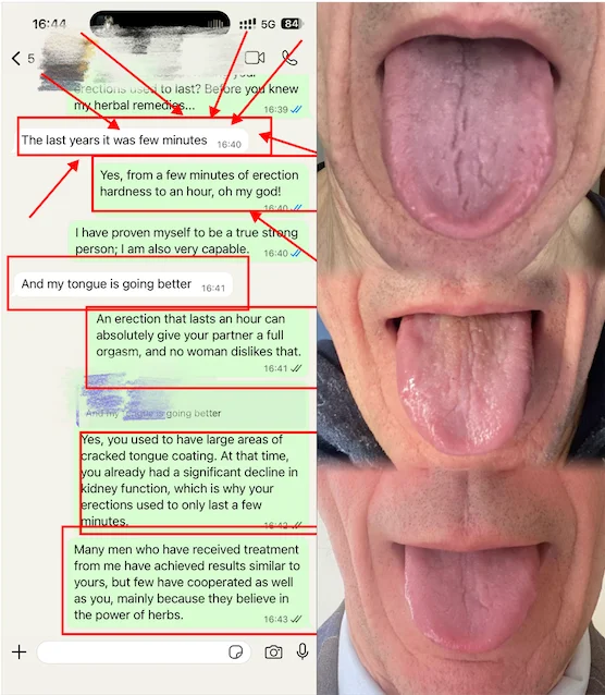 Tongue diagnosis